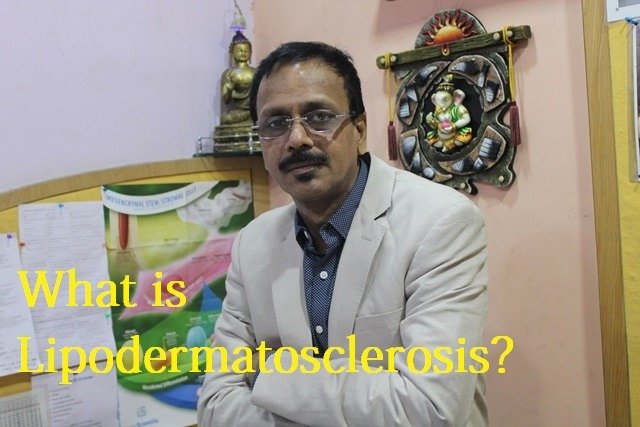 article on Lipodermatosclerosis